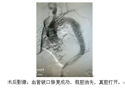 ADB79E85493CEE72FE045294EAF_E873988E_12F66.png