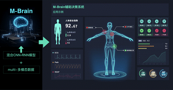 M_Brain辅助决策系统